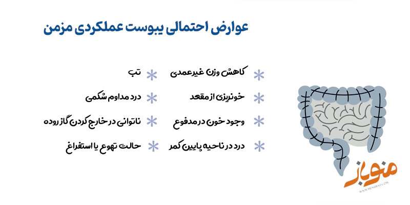 عوارض احتمالی یبوست عملکردی مزمن